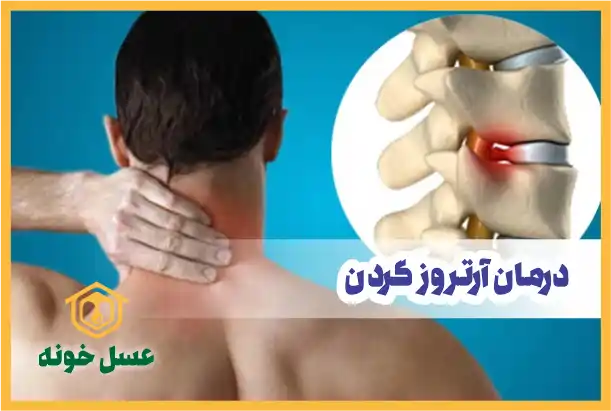 درمان آرتروز گردن با عسل