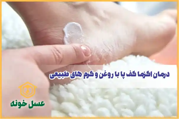 درمان اگزما کف پا با روغن و کرم های طبیعی