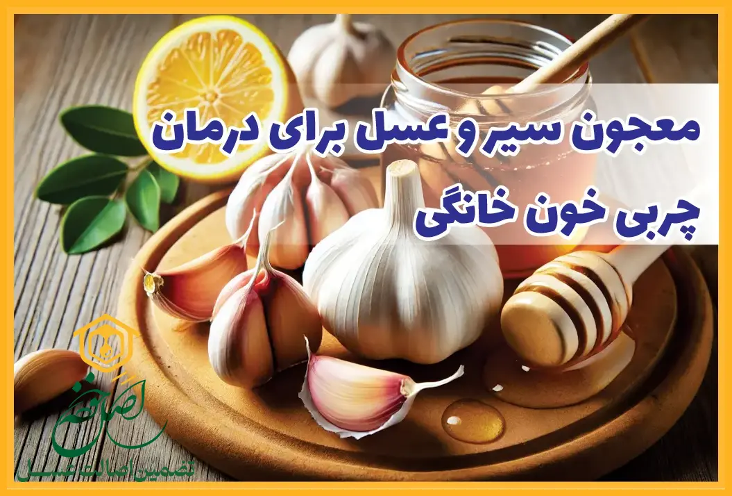 درمان خانگی چربی خون