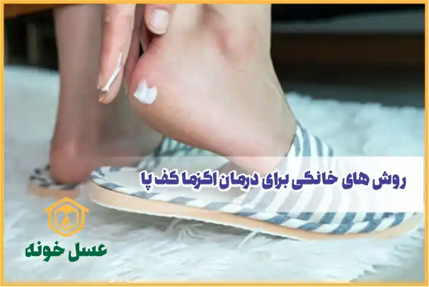 روش های خانگی برای درمان اگزما کف پا