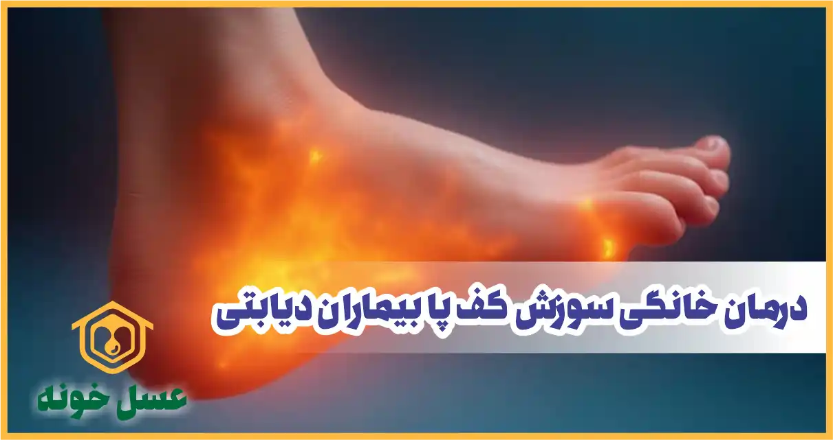 درمان سوزش کف پا بیماران دیابتی