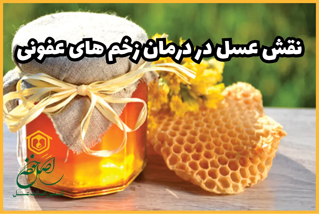 نقش عسل در درمان زخم های عفونی