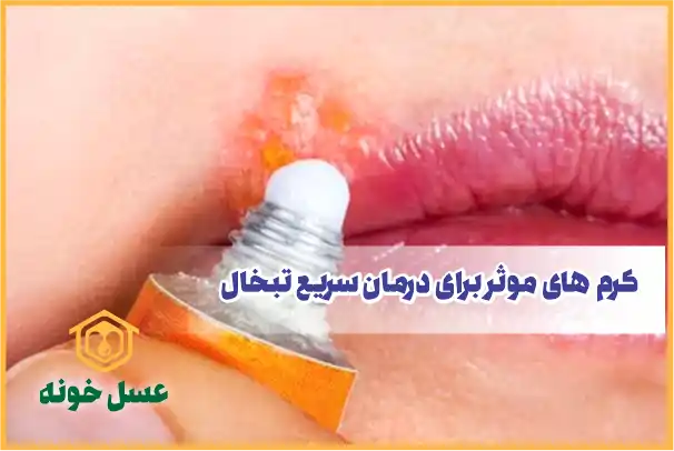 کرم های موثر برای درمان سریع تبخال
