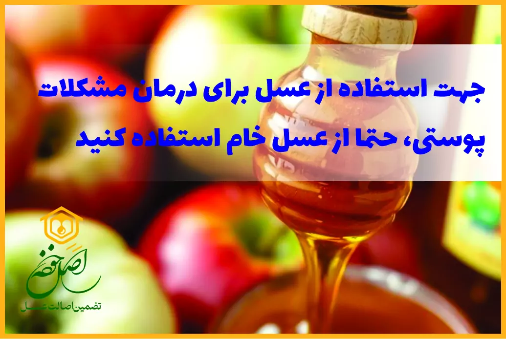 استفاده از سرکه برای درمان لک 