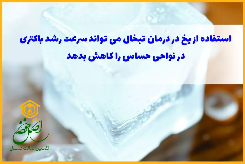 درمان تبخال خانگی